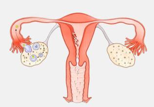 女性健康：保护卵巢和子宫